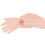 A hand holding a semi transparent wrist, showing the bones. There is a reddened area to show pain.
